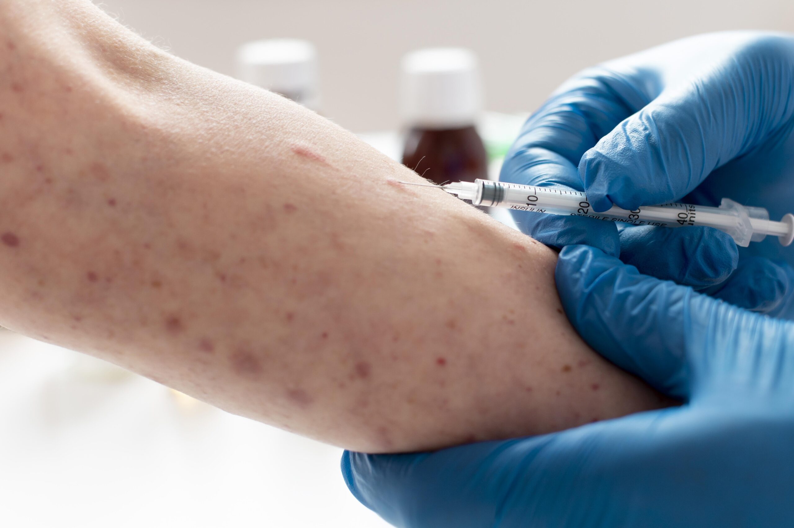 Measles Elimination Status Lost: A Warning for the United States